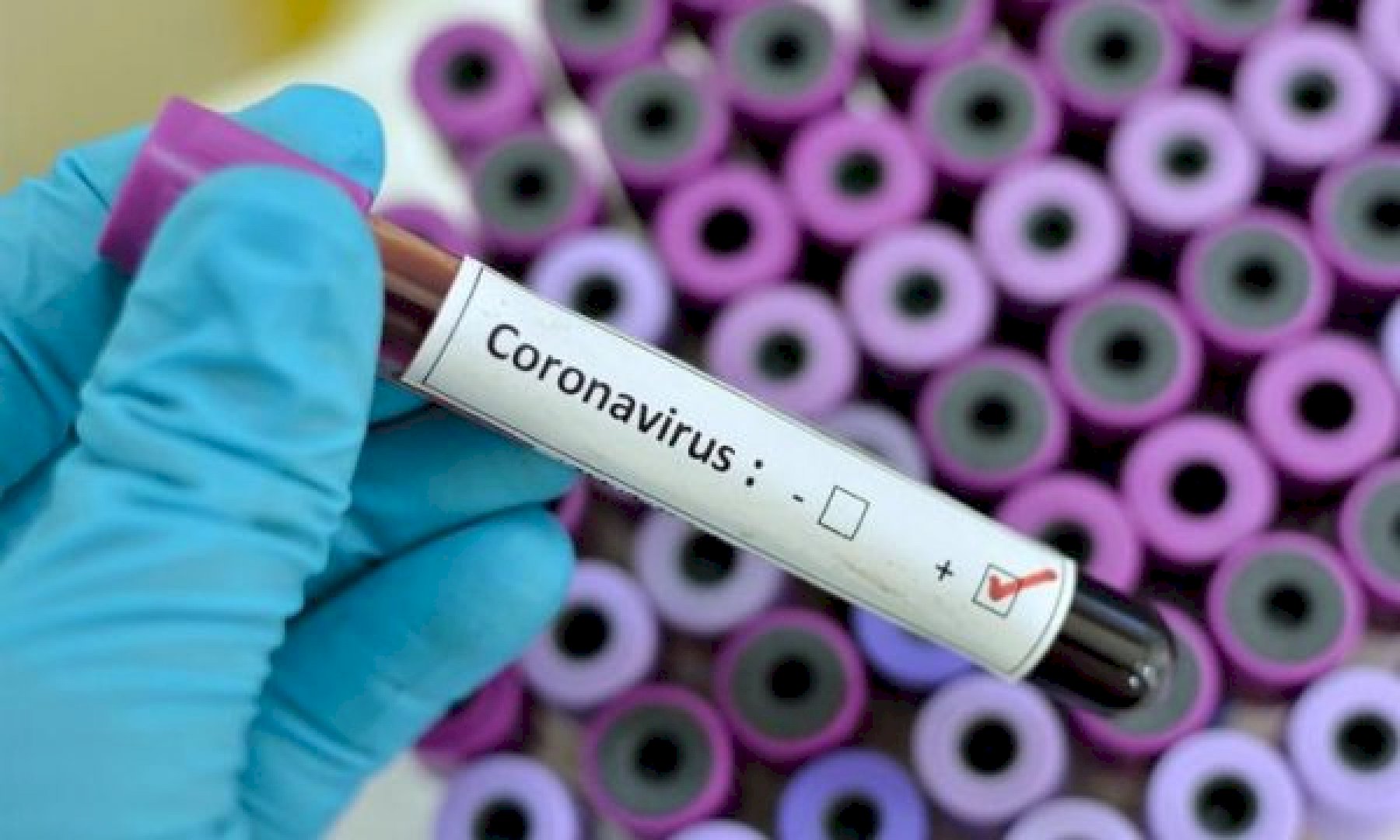 infektohet-me-koronavirus-infermierja-kosovare