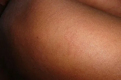 cyrihu-leshon-alarmin-per-fruthin