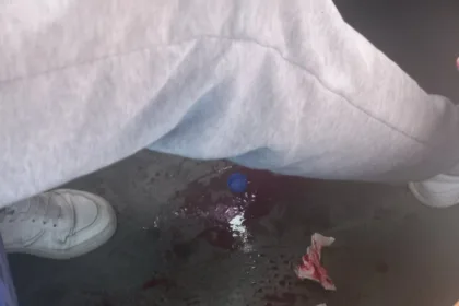 gjakosen-pasagjeret-ne-obiliq,-u-sulmuan-me-gure-teksa-po-udhetonin-me-tren